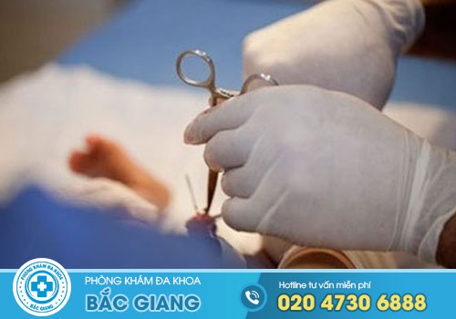 Cắt bao quy đầu bao lâu thì tắm được