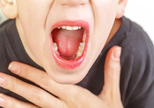 Nổi hạt ở cuống lưỡi không đau là bị gì