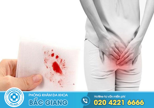 TOP 8 Địa chỉ Cắt Trĩ ở Sơn Động Bắc Giang tốt nhất