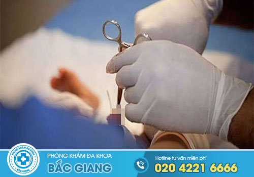 TOP 9 Địa chỉ Cắt Bao Quy Đầu ở Lạng Giang, Bắc Giang