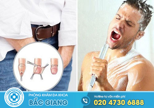 Cắt bao quy đầu bao lâu thì tắm được