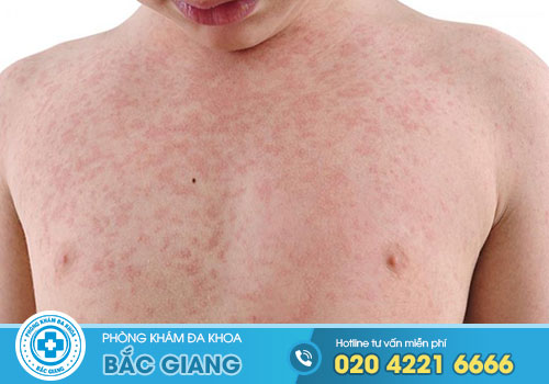 10 Phòng khám da liễu Quế Võ, Bắc Ninh tốt nhất
