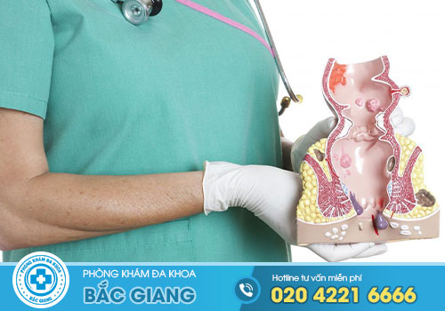 10 Địa chỉ khám, chữa Bệnh Trĩ ở Bắc Giang uy tín nhất