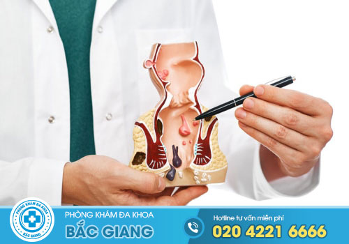 TOP 10 Khám, Chữa bệnh Trĩ ở Yên Dũng Bắc Giang tốt nhất