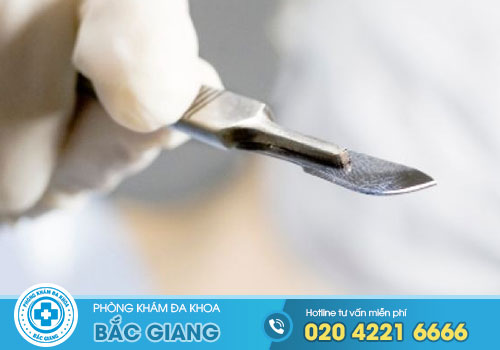 TOP 8 Địa chỉ Cắt Trĩ ở Lạng Giang, Bắc Giang tốt nhất